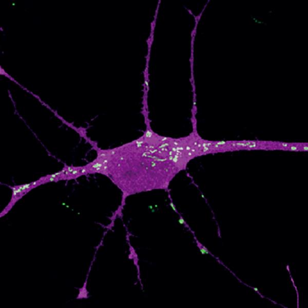 A purple human neuron with white mitocho<em></em>ndria dotting the surface