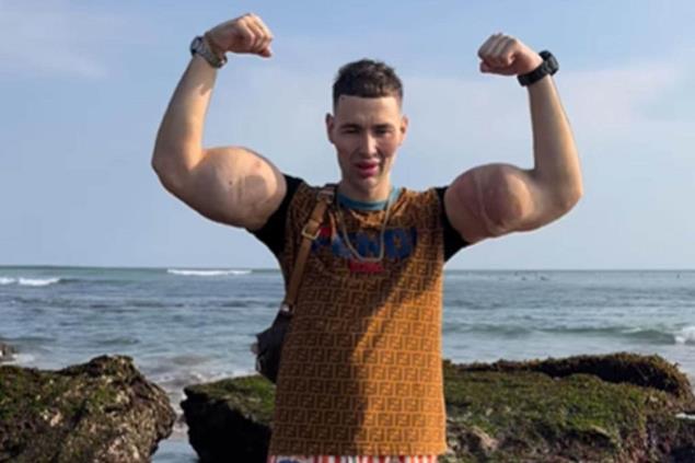 Viral Video Of Russian Man Flexing His Biceps Stuns Internet